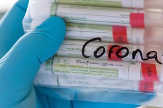 Covid-19-Fall in Gemeinschaftsunterkunft in Zschopau -