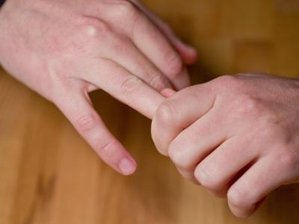 Das Geschäft mit Arthrose -
