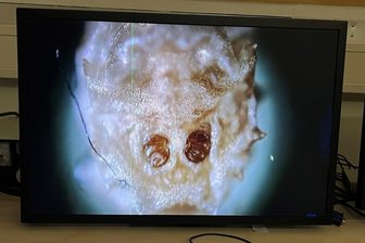 Bei der Nacht der Wissenschaften an der Hochschule Mittweida wurden Bilder von Insekten gezeigt, die bei Mordermittlungen entscheidend sein können. Dieses Foto zeigt eine Made.