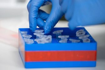 Eine Laborantin führt Untersuchungen zum Coronavirus durch.