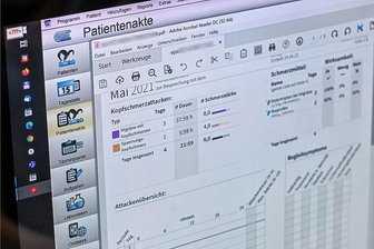 Elektronische Patientenakte: Bis 2025 soll jeder eine bekommen - Schluss mit Röntgenaufnahmen auf CD und Zettelwirtschaft im Gesundheitswesen: Ab 2025 soll die digitalen Patientenakte für jeden zur Regel werden. 
