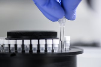 Erzgebirge: Gesundheitsamt schaltet Corona-Hotline -