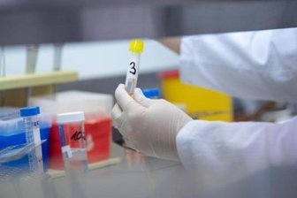 Erzgebirgskreis: 13 neue Todesfälle im Zusammenhang mit Corona -