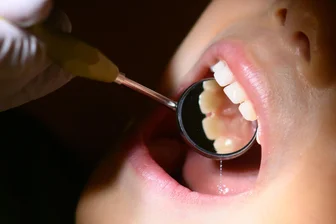 Fachmediziner dringend gesucht: Wie lockt man mehr Zahnärzte ins Vogtland? - Auch Zahnärzte fehlen im Vogtland. Könnten sie nach dem Vorbild der Hausärzte ebenso in den Praxen der Region weitergebildet werden?