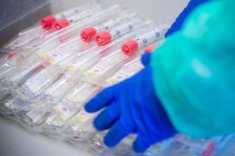 Testsets mit Abstrichstäbchen liegen in einem Testzentrum für Corona-Verdachtsfälle.
