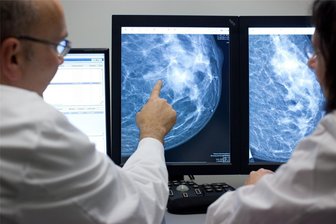 Frauen in Sachsen gehen immer seltener zur Mammografie - Mammografie macht Auffälligkeiten in der Brust sichtbar.
