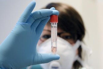 Fünf neue Corona-Infektionen in Sachsen -