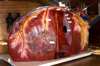 Gesundheitsamt des Vogtlandkreises präsentiert sich am Mittwoch mit Aktionstag in Plauen der Öffentlichkeit - Ein „begehbares Herzmodell“ gehört zu den Höhepunkten des Tages des Gesundheitsamtes im Plauener Landratsamt.