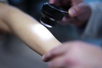 Hautkrebs in Sachsen: Kritik an Kürzungen bei Früherkennung - In Sachsen sind seit 2015 mehr als 2.200 Menschen an Hautkrebs gestorben. (Symbolbild)