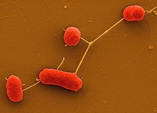HUSEC 41 als Übeltäter entlarvt - HUSEC 41 ist verantwortlich für den dramatischen Ausbruch von Infektionen mit dem Darmkeim EHEC. Forscher des Instituts für Hygiene des Universitätsklinikums Münster gelang es, den genauen Typ des Erregers zu identifizieren. Der Übeltäter gehört zu den seltenen Varianten und ist resistent gegen viele Antibiotika.