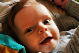 In Rudis Brust schlägt jetzt ein Spenderherz - Der kleine Rudi - hier kurz vor der Herztransplantation - ist ein Kämpfer. Er hat in den nicht einmal sieben Monaten seines Lebens bereits zwei 14-stündige Operationen überstanden.