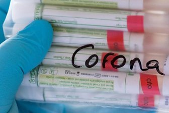 Proben für Corona-Tests werden für die weitere Untersuchung vorbereitet.