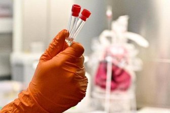 Italien-Reisende steht vorsorglich unter Quarantäne -