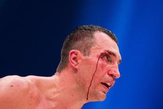 Klitschko nach Totalschaden gegen Fury: «Fortsetzung folgt» -