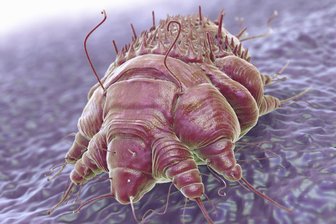 Krätze im Erzgebirgskreis: Deutlich weniger Fälle als 2025 - Unter dem Mikroskop sieht sie furchteinflößend aus: die Krätzemilbe.