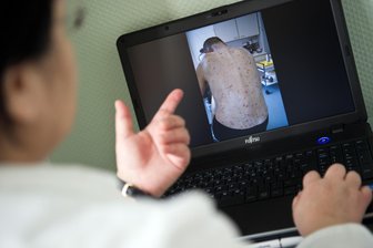 Krätze ist in Sachsen auf dem Vormarsch - auch im Vogtland? - Erst bilden sich Pusteln, dann juckt die Haut. Krätze ist für die diese Ärztin Alltag.