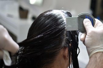 Läuse in Kita oder Schule? - So untersuchen Sie Ihr Kind - Gründliche Untersuchung ist entscheidend: Mit einem Läusekamm und einer Haarspülung lassen sich Läuse und Eier im feuchten Haar am zuverlässigsten aufspüren.