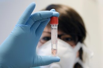 Landkreis Zwickau: 341 Corona-Fälle am Montag - Die Zahl der mit dem Coronavirus infizierten Menschen im Landkreis Zwickau ist bis Montagvormittag, 11 Uhr, auf 341 gestiegen.