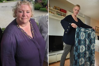 Letzter Ausweg: Operation - Dieselbe Frau: Kornelia Bretschneider vor der OP (links) und heute. Zwischen beiden Aufnahmen liegen 18 Monate. 