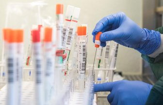Mehr als 100 Menschen im Erzgebirgskreis derzeit in Quarantäne - 
