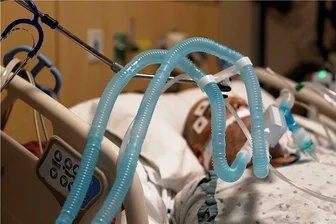 Mehr Corona-Patienten in Krankenhäusern: Wie gut schützt die Impfung? - Letzter Versuch Beatmungsgerät - bei Geimpften die große Ausnahme.