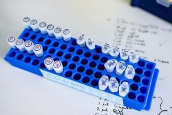 Mitarbeiter des Landratsamtes mit Corona infiziert -