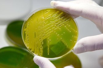 Multiresistente Keime in Sachsen auf dem Vormarsch -