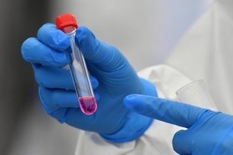 Nach Laborpanne: Weitere Coronafälle am Landeskrankenhaus Rodewisch -