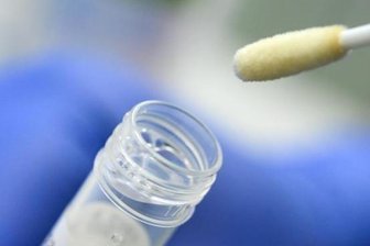 Negativ oder positiv? Testzentren stocken ihr Personal auf - 