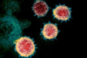 Neue Corona-Variante: Warum Sachsen eine Verschärfung der Regeln nicht für notwendig hält - Das Virus Sars-CoV-2 in einer elektronenmikroskopische Aufnahme vom Februar 2020. Eine neue Variante, EG.5 oder auch "Eris" getauft, ist von der WHO als "Variante von Interesse" eingestuft worden.