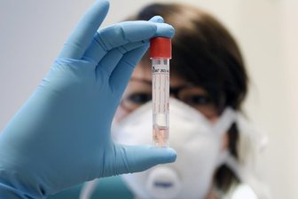 Newsblog Corona: Anzahl der Neuinfektionen erreicht Höchstwert -