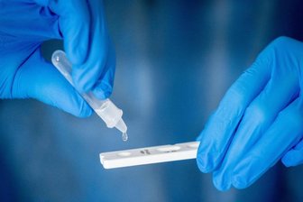 Medizinisch geschultes Personal führt einen Corona-Schnelltest durch.