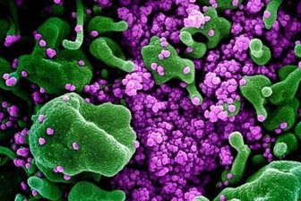 Eine Zelle (grün) ist mit dem Coronavirus (SARS-CoV-2, violett) infiziert.
