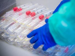 Newsblog Corona - die aktuelle Entwicklung - Testsets mit Abstrichstäbchen liegen in einem Testzentrum.