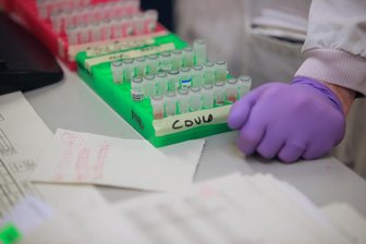 Newsblog Corona: Inzidenz in Deutschland sinkt auf unter 80 -