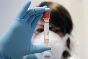 Newsblog Corona: Inzidenz in Deutschland sinkt nur geringfügig -
