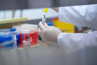 Newsblog Corona: Neue Virus-Variante löst Besorgnis aus -
