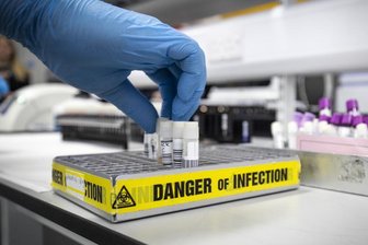 Newsblog Corona: Virus-Mutation bei Nerzen - Dänemark gräbt Tiere aus - 