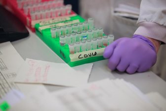 Newsblog Corona: Wenig Veränderung bei Infektionsgeschehen -