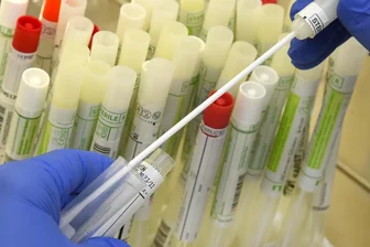 Newsblog Corona: WHO benennt Virus-Varianten nicht mehr nach Ländern - 