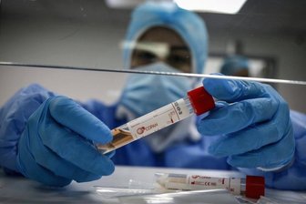 Newsblog Coronavirus - die aktuelle Entwicklung -