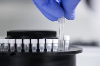 Newsblog Coronavirus - die aktuelle Entwicklung -