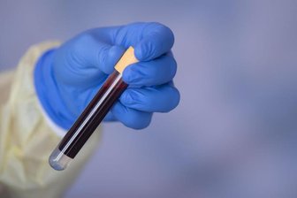 Eine Blutprobe für einen Antikörpertest beim RKI.