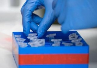 Newsblog Coronavirus - die aktuelle Entwicklung -