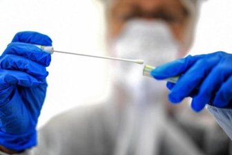 Newsblog Coronavirus - die aktuelle Entwicklung - Abstrichstäbchen in einer ambulanten Corona-Test-Einrichtung.