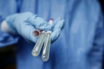 Newsblog Coronavirus - die aktuelle Entwicklung -
