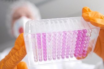 Eine Virologin untersucht Proben auf das Coronavirus.