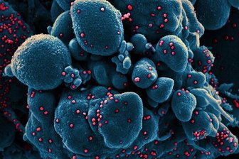 Newsblog Coronavirus - die aktuelle Entwicklung -