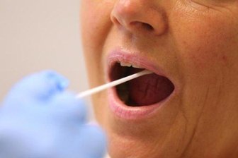 Newsblog Coronavirus - die aktuelle Entwicklung - Ein Arzt nimmt in einer Hausarztpraxis mit einem Tupfer einen Abstrich bei einer Frau für einen Corona-Test.