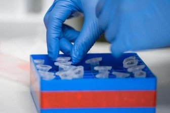 Newsblog Coronavirus - die aktuelle Entwicklung -